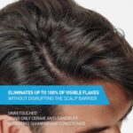 CeraVe Anti-Dandruff Shampoo: Soothes Itchy Scalp, Eliminates Flakes. - Image 2