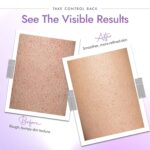 Exfoliating Body Scrub for Keratosis Pilaris and Rough Skin - Image 3