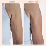 Crepe Erase Body Exfoliant: Smooths Dry Skin & Texture - Image 3